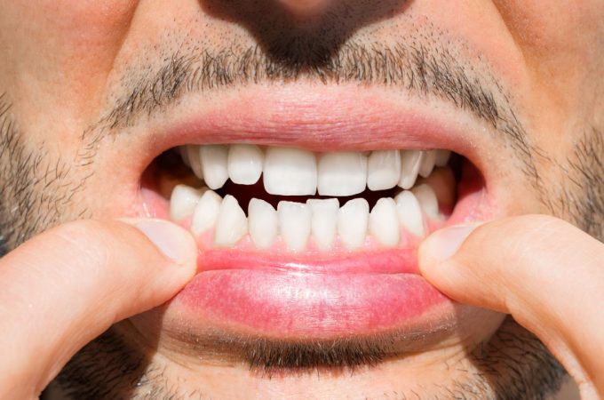 Care sunt tipurile de dinti si ce rol au